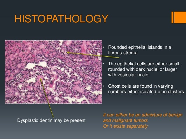 Benign odontogenic tumors 1