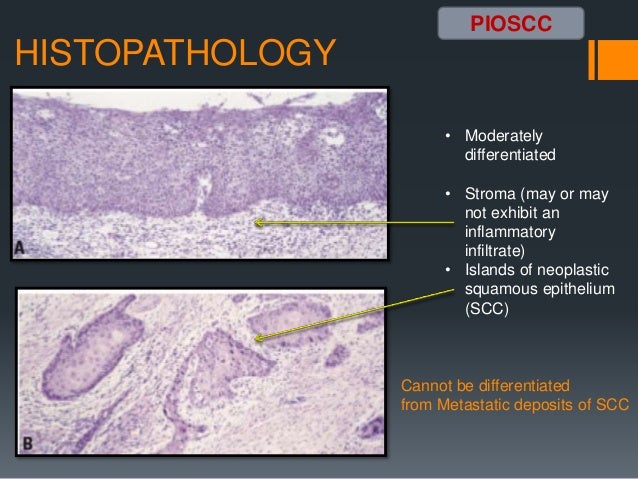 Benign odontogenic tumors 1