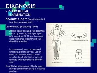 Benign positional vertigo | PPT