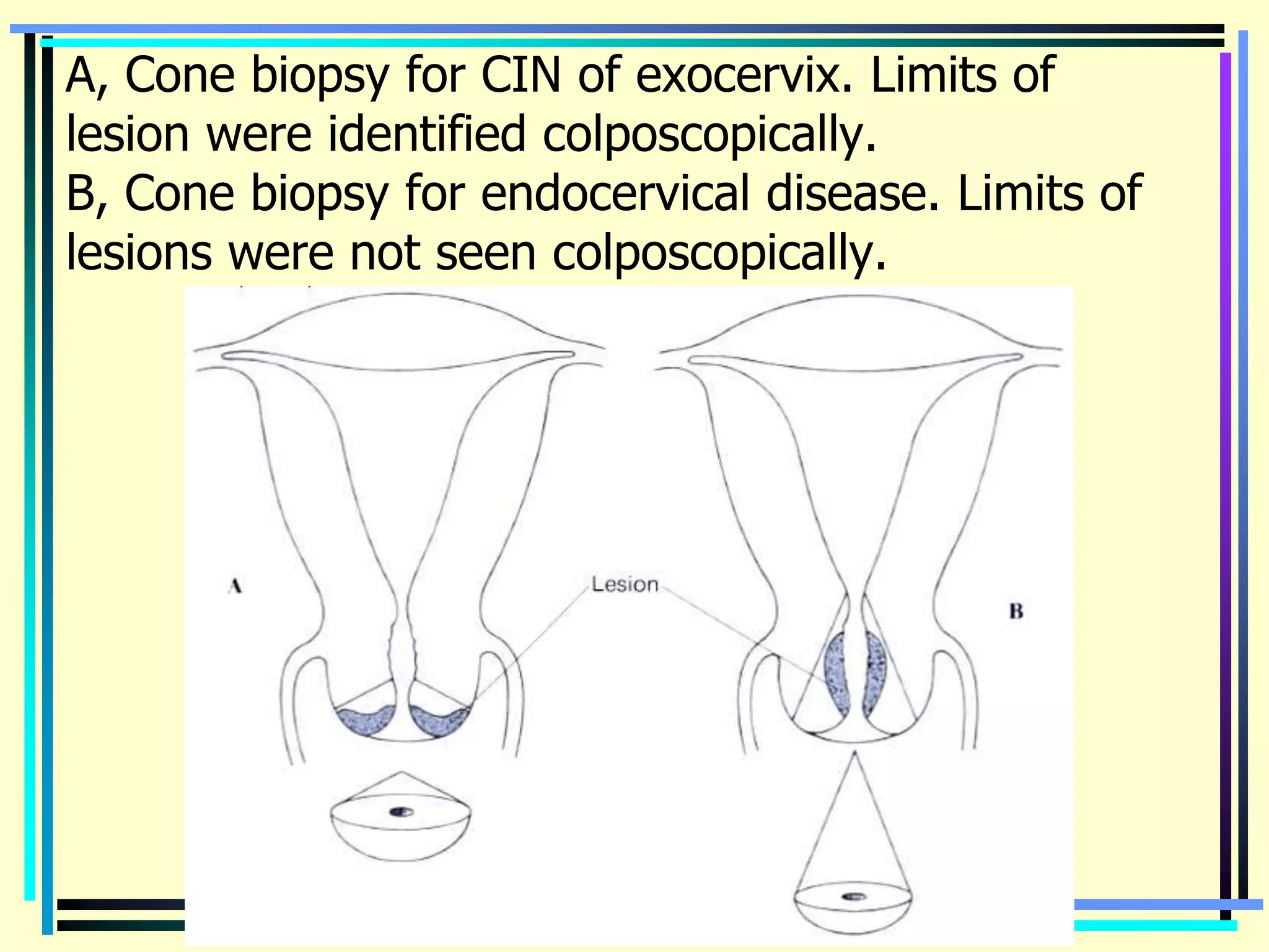 Benign & precancerous tumors of female genital organs | PPTX
