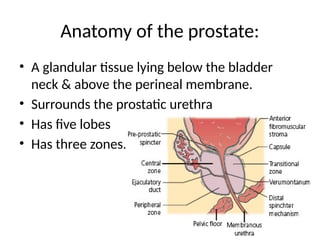 Benign prostate hyperplasia DR BIENFAIT.pptx