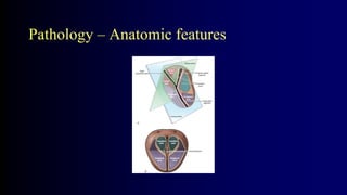 Pathology – Anatomic features
 