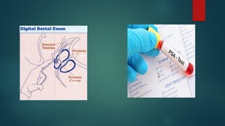 Benign prostate hypertrophy.pptx        .