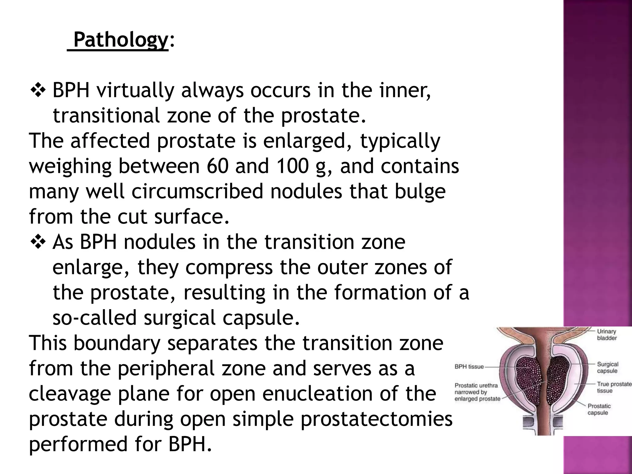 Pathology:
 BPH virtually always occurs in the inner,
transitional zone of the prostate.
The affected prostate is enlarged, typically
weighing between 60 and 100 g, and contains
many well circumscribed nodules that bulge
from the cut surface.
 As BPH nodules in the transition zone
enlarge, they compress the outer zones of
the prostate, resulting in the formation of a
so-called surgical capsule.
This boundary separates the transition zone
from the peripheral zone and serves as a
cleavage plane for open enucleation of the
prostate during open simple prostatectomies
performed for BPH.
 