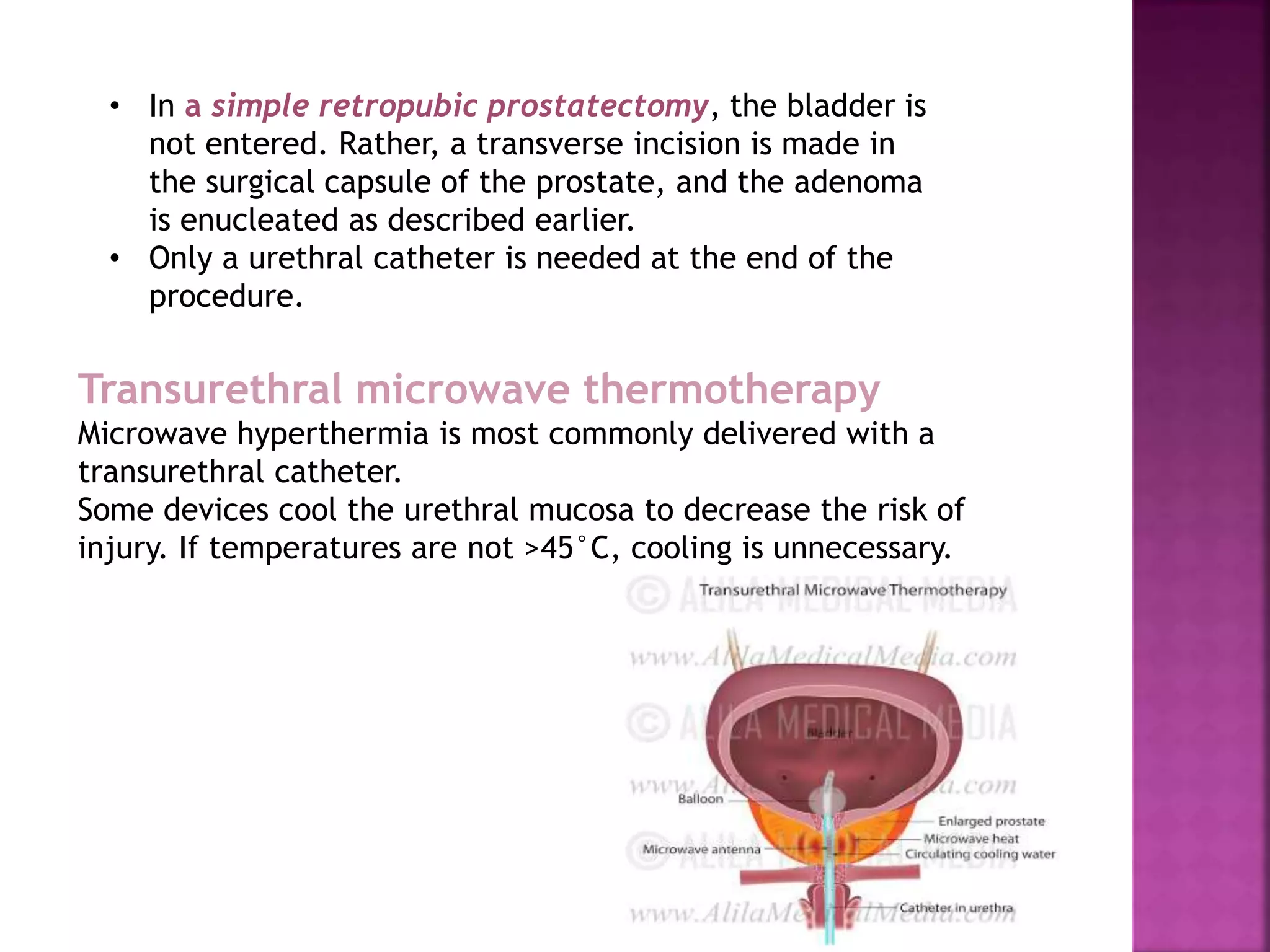 • In a simple retropubic prostatectomy, the bladder is
not entered. Rather, a transverse incision is made in
the surgical capsule of the prostate, and the adenoma
is enucleated as described earlier.
• Only a urethral catheter is needed at the end of the
procedure.
Transurethral microwave thermotherapy
Microwave hyperthermia is most commonly delivered with a
transurethral catheter.
Some devices cool the urethral mucosa to decrease the risk of
injury. If temperatures are not >45°C, cooling is unnecessary.
 