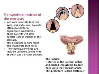 • In a simple retropubic prostatectomy, the bladder is
not entered. Rather, a transverse incision is made in
the surgical ...
