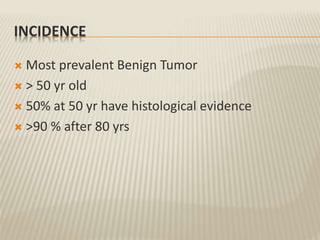 INCIDENCE
 Most prevalent Benign Tumor
 > 50 yr old
 50% at 50 yr have histological evidence
 >90 % after 80 yrs
 