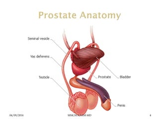 Benign prostatic hyperplasia | PDF