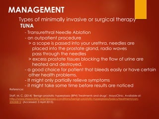 MANAGEMENT
Types of minimally invasive or surgical therapy
TUNA
- Transurethral Needle Ablation
- an outpatient procedure
...