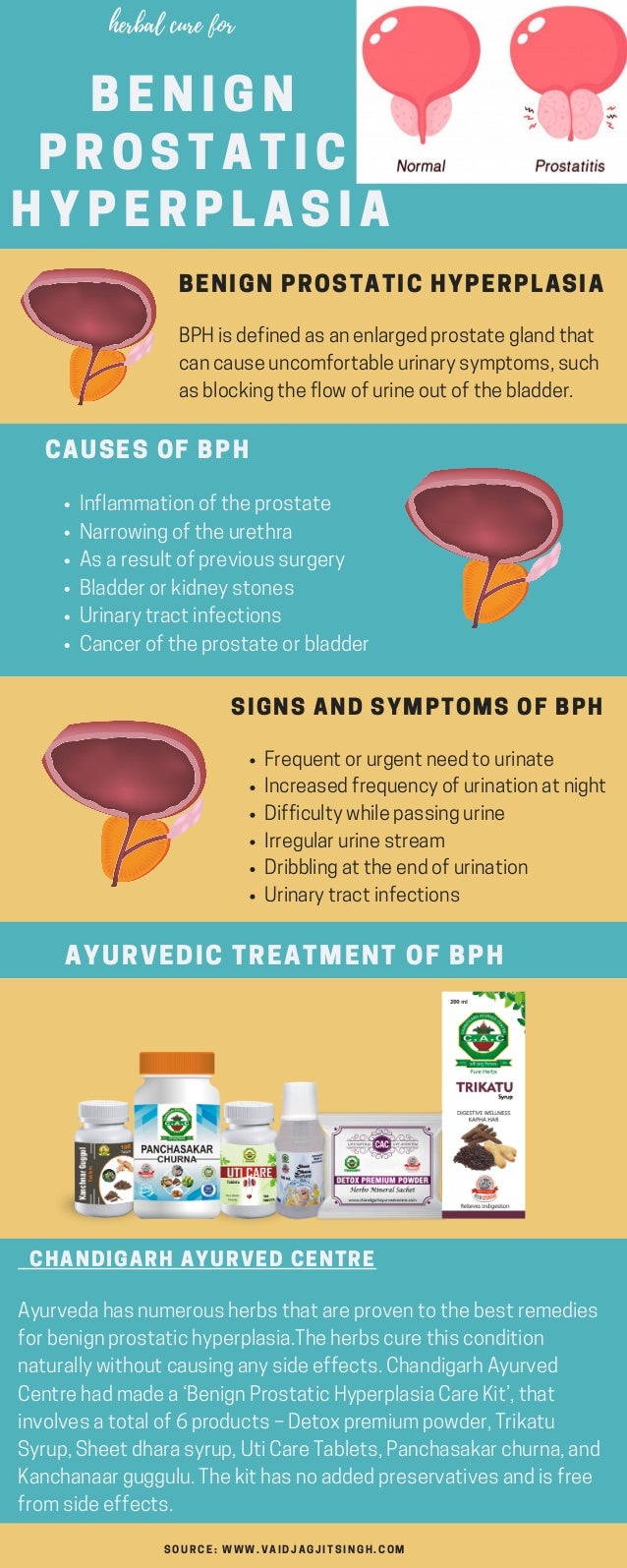 Bph Benign Prostatic Hyperplasia Causes Symptoms And Herbal Treatment