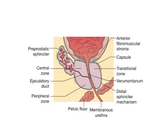 Comprehensive Overview of Benign Prostatic Hyperplasia: Anatomy ...