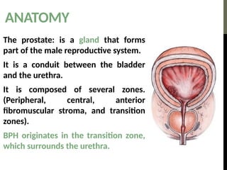 Comprehensive Overview of Benign Prostatic Hyperplasia (BPH): Causes ...