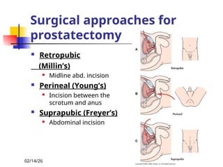 Retropubic Incision Benign Prostatic Hyperplasia POWER POINT PRESENTATION | PPT