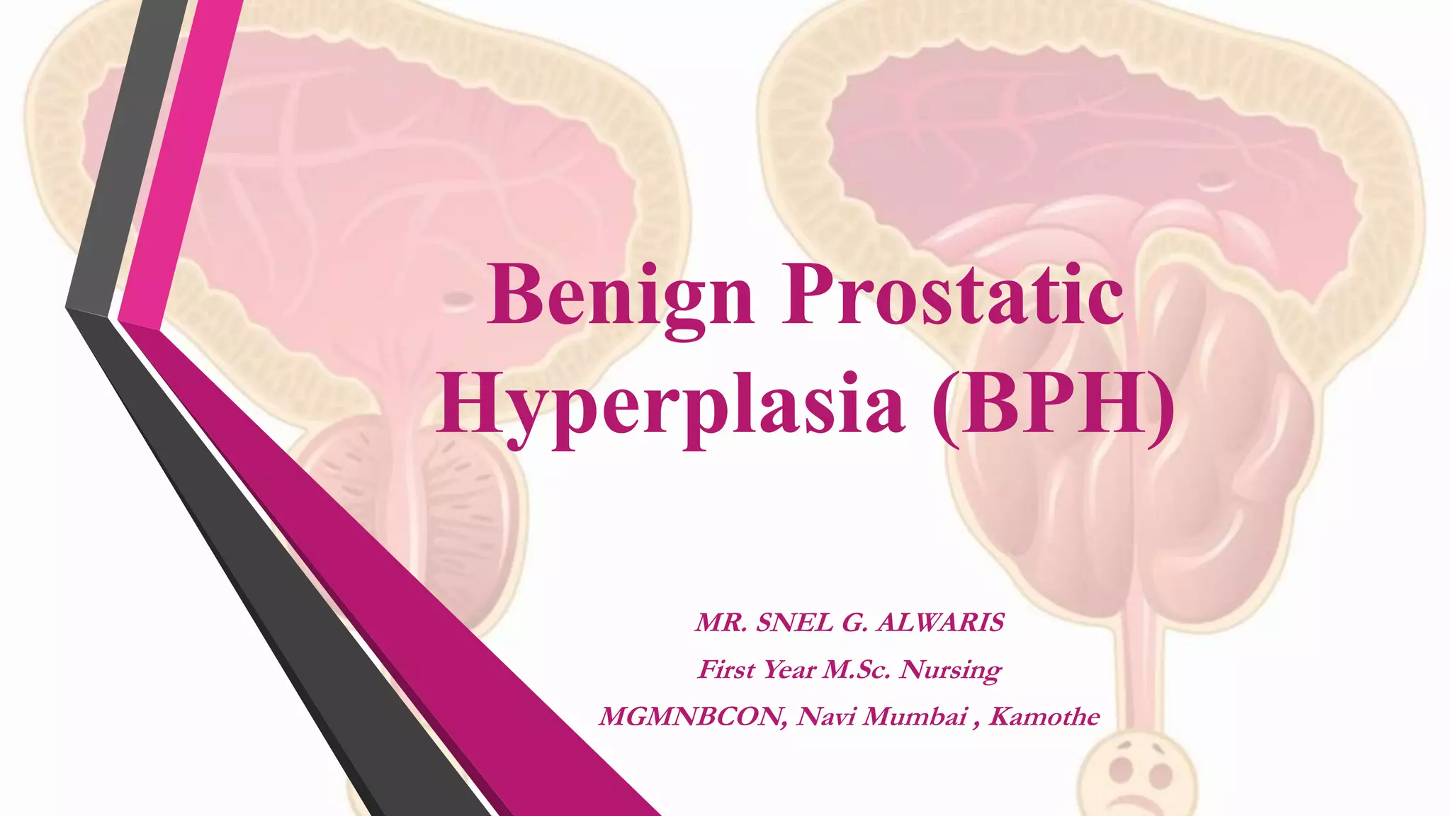 Benign prostatic hyperplasia (bph) | PPTX