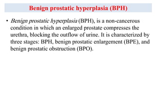 Benign Prostatic Hyperplasia (BPH)-I CU_250914_163946.pdf