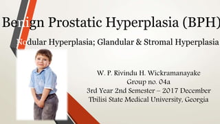 Benign Prostatic Hyperplasia (BPH)
Nodular Hyperplasia; Glandular & Stromal Hyperplasia
W. P. Rivindu H. Wickramanayake
Group no. 04a
3rd Year 2nd Semester – 2017 December
Tbilisi State Medical University, Georgia
 