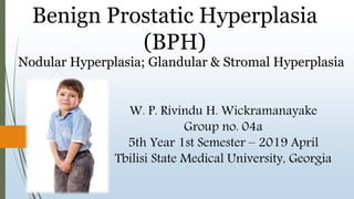 Benign Prostatic Hyperplasia
(BPH)
Nodular Hyperplasia; Glandular & Stromal Hyperplasia
W. P. Rivindu H. Wickramanayake
Group no. 04a
5th Year 1st Semester – 2019 April
Tbilisi State Medical University, Georgia
 