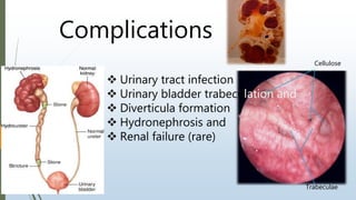 Complications
 Urinary tract infection
 Urinary bladder trabeculation and
 Diverticula formation
 Hydronephrosis and
 Renal failure (rare)
Cellulose
Trabeculae
 