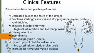 Clinical Features
Presentation based on pinching of urethra
Decreased caliber and force of the stream
Problems starting(hesitancy) and stopping urine stream; post-
void dribbling
Impaired bladder emptying
- high risk of infection and hydronephrosis
Urinary retention
Incontinence
Nocturia; polyuria / Dysuria
Hypertrophy of bladder wall muscle
- increased risk for bladder diverticula
Microscopic hematuria maybe present
 
