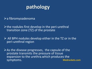 a fibromyoadenoma
the nodules first develop in the peri-urethral
transition zone (TZ) of the prostate
 All BPH nodules develop either in the TZ or in the
peri-urethral region
As the disease progresses, the capsule of the
prostate transmits the pressure of tissue
expansion to the urethra.which produces the
symptoms.
pathology
Medrockets.com
 