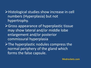 Histological studies show increase in cell
numbers (Hyperplasia) but not
hypertrophy.
Gross appearance of hyperplastic tissue
may show lateral and/or middle lobe
enlargement and/or posterior
commissural hyperplasia
The hyperplastic nodules compress the
normal periphery of the gland which
forms the false capsule.
Medrockets.com
 