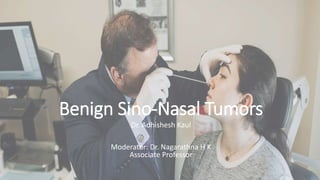 Benign Sino-Nasal Tumors
Dr. Adhishesh Kaul
Moderator: Dr. Nagarathna H K
Associate Professor
 
