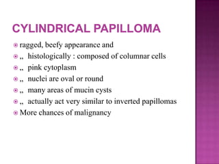  ragged, beefy appearance and
 „ histologically : composed of columnar cells
 „ pink cytoplasm
 „ nuclei are oval or round
 „ many areas of mucin cysts
 „ actually act very similar to inverted papillomas
 More chances of malignancy
 