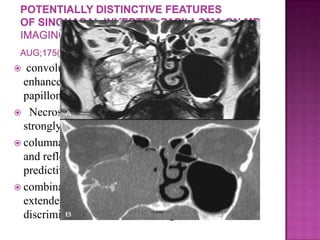  convoluted cerebriform pattern on T2- or
enhanced T1-weighted images suggests inverted
papilloma as a histologic diagnosis
 Necrosis in a mass with such an appearance
strongly suggests coexistent carcinoma
 columnar pattern is a reliable MRI indicator of IP
and reflects its histological architecture (positive
predictive value of 95.8%)
 combination of this finding with the absence of
extended bone erosion allows for the confident
discrimination of IPs from malignant tumors
 