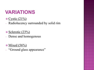  Cystic (21%)
- Radiolucency surrounded by solid rim
 Sclerotic (23%)
- Dense and homogenous
 Mixed (56%)
- “Ground glass appearance”
 