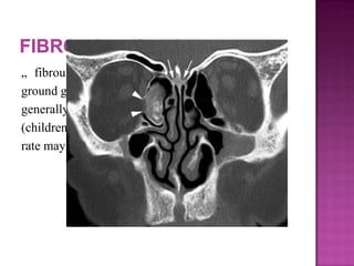 „ fibrous dysplasia characteristically has a
ground glass appearance on CT images. . It
generally presents in younger patients
(children and adolescents), and its growth
rate may decrease or stop after puberty
 