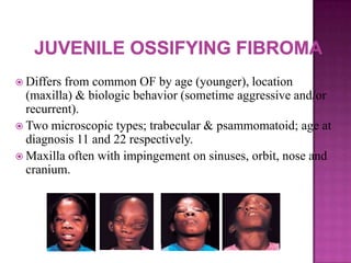  Differs from common OF by age (younger), location
(maxilla) & biologic behavior (sometime aggressive and/or
recurrent).
 Two microscopic types; trabecular & psammomatoid; age at
diagnosis 11 and 22 respectively.
 Maxilla often with impingement on sinuses, orbit, nose and
cranium.
 