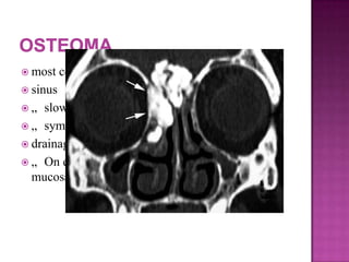  most commonly localized to the frontal
 sinus
 „ slow growing and well circumscribed
 „ symptoms attributable obstruction of the
 drainage pathway of nearby sinuses
 „ On endoscopy : firm masses with a smooth
mucosal covering
 
