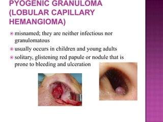  misnamed; they are neither infectious nor
granulomatous
 usually occurs in children and young adults
 solitary, glistening red papule or nodule that is
prone to bleeding and ulceration
 