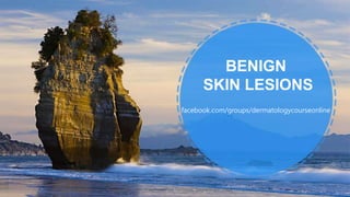 BENIGN
SKIN LESIONS
ALLPPT.com _ Free PowerPoint Templates, Diagrams and Charts
facebook.com/groups/dermatologycourseonline
 