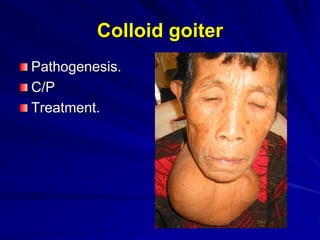 Benign Thyroid-Y6.ppt