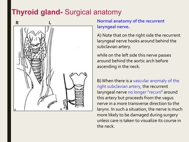 Benign Thyroid Swellings | PPT