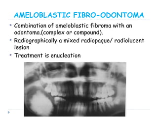 AMELOBLASTIC FIBRO-ODONTOMA
 Combination of ameloblastic fibroma with an
odontoma.(complex or compound).
 Radiographically a mixed radiopaque/ radiolucent
lesion
 Treatment is enucleation
 