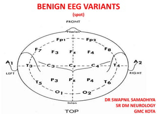 BENIGN EEG VARIANTS
(spot)
DR SWAPNIL SAMADHIYA
SR DM NEUROLOGY
GMC KOTA
 