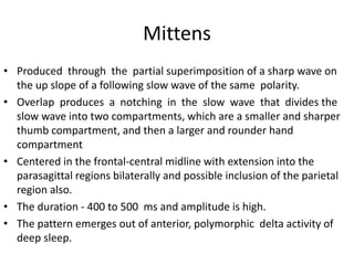 Mittens
• Produced through the partial superimposition of a sharp wave on
the up slope of a following slow wave of the same polarity.
• Overlap produces a notching in the slow wave that divides the
slow wave into two compartments, which are a smaller and sharper
thumb compartment, and then a larger and rounder hand
compartment
• Centered in the frontal-central midline with extension into the
parasagittal regions bilaterally and possible inclusion of the parietal
region also.
• The duration - 400 to 500 ms and amplitude is high.
• The pattern emerges out of anterior, polymorphic delta activity of
deep sleep.
 