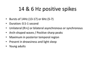 14 & 6 Hz positive spikes
• Bursts of 14Hz (13-17) or 6Hz (5-7)
• Duration: 0.5-1 second
• Unilateral (R>L) or bilateral asynchronous or synchronous
• Arch-shaped waves / Positive sharp peaks
• Maximum in posterior temporal region
• Present in drowsiness and light sleep
• Young adults
 