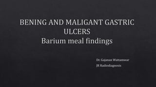 BENING AND MALIGANT GASTRIC ULCERS- Barium meal findings.pptx