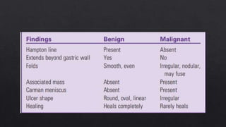 Hampton Line BENING AND MALIGANT GASTRIC ULCERS- Barium meal findings.pptx