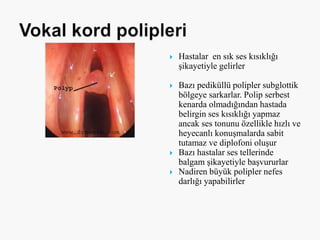  Hastalar en sık ses kısıklığı
şikayetiyle gelirler
 Bazı pediküllü polipler subglottik
bölgeye sarkarlar. Polip serbest
kenarda olmadığından hastada
belirgin ses kısıklığı yapmaz
ancak ses tonunu özellikle hızlı ve
heyecanlı konuşmalarda sabit
tutamaz ve diplofoni oluşur
 Bazı hastalar ses tellerinde
balgam şikayetiyle başvururlar
 Nadiren büyük polipler nefes
darlığı yapabilirler
 
