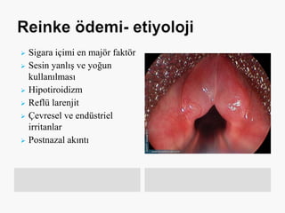  Sigara içimi en majör faktör
 Sesin yanlış ve yoğun
kullanılması
 Hipotiroidizm
 Reflü larenjit
 Çevresel ve endüstriel
irritanlar
 Postnazal akıntı
 