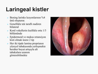  Bening larinks lezyonlarının %4
ünü oluşturur.
 Genellikle tek taraflı nadiren
bilateral
 Kord vokallerin özellikle orta 1/3
bölümünde
 Epidermoid ve mukus retansiyon
kisti olmak üzere 2 tip
 Her iki tipde lamina proprianın
yüzeyel tabakasında yerleşmekte
beraber boyut artışıyla alt
tabakalara uzanım
gösterebilmekte
 