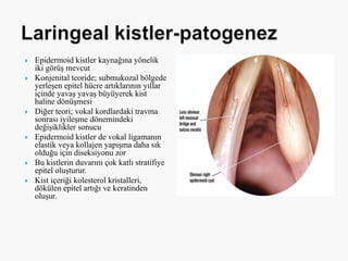  Epidermoid kistler kaynağına yönelik
iki görüş mevcut
 Konjenital teoride; submukozal bölgede
yerleşen epitel hücre artıklarının yıllar
içinde yavaş yavaş büyüyerek kist
haline dönüşmesi
 Diğer teori; vokal kordlardaki travma
sonrası iyileşme dönemindeki
değişiklikler sonucu
 Epidermoid kistler de vokal ligamanın
elastik veya kollajen yapışma daha sık
olduğu için diseksiyonu zor
 Bu kistlerin duvarını çok katlı stratifiye
epitel oluşturur.
 Kist içeriği kolesterol kristalleri,
dökülen epitel artığı ve keratinden
oluşur.
 