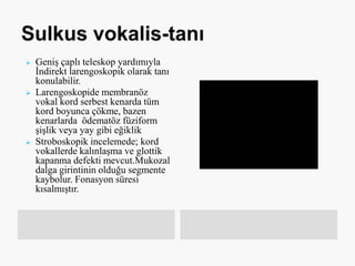  Geniş çaplı teleskop yardımıyla
İndirekt larengoskopik olarak tanı
konulabilir.
 Larengoskopide membranöz
vokal kord serbest kenarda tüm
kord boyunca çökme, bazen
kenarlarda ödematöz füziform
şişlik veya yay gibi eğiklik
 Stroboskopik incelemede; kord
vokallerde kalınlaşma ve glottik
kapanma defekti mevcut.Mukozal
dalga girintinin olduğu segmente
kaybolur. Fonasyon süresi
kısalmıştır.
 
