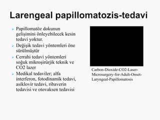  Papillomatöz dokunun
gelişimini önleyebilecek kesin
tedavi yoktur.
 Değişik tedavi yöntemleri öne
sürülmüştür
 Cerrahi tedavi yöntemleri
soğuk mikroşirürjik teknik ve
CO2 lazer
 Medikal tedaviler; alfa
interferon, fotodinamik tedavi,
asiklovir tedavi, ribaverin
tedavisi ve otovaksen tedavisi
Carbon-Dioxide-CO2-Laser-
Microsurgery-for-Adult-Onset-
Laryngeal-Papillomatosis
 