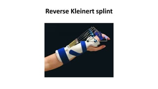 Reverse Kleinert splint
 