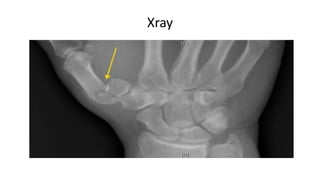 Xray
 
